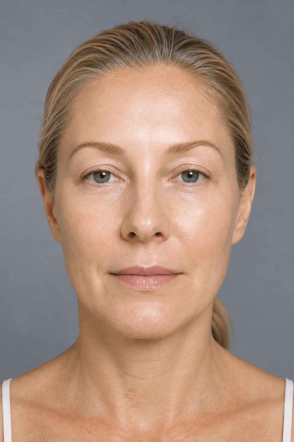 After facial treatment — illustrative example