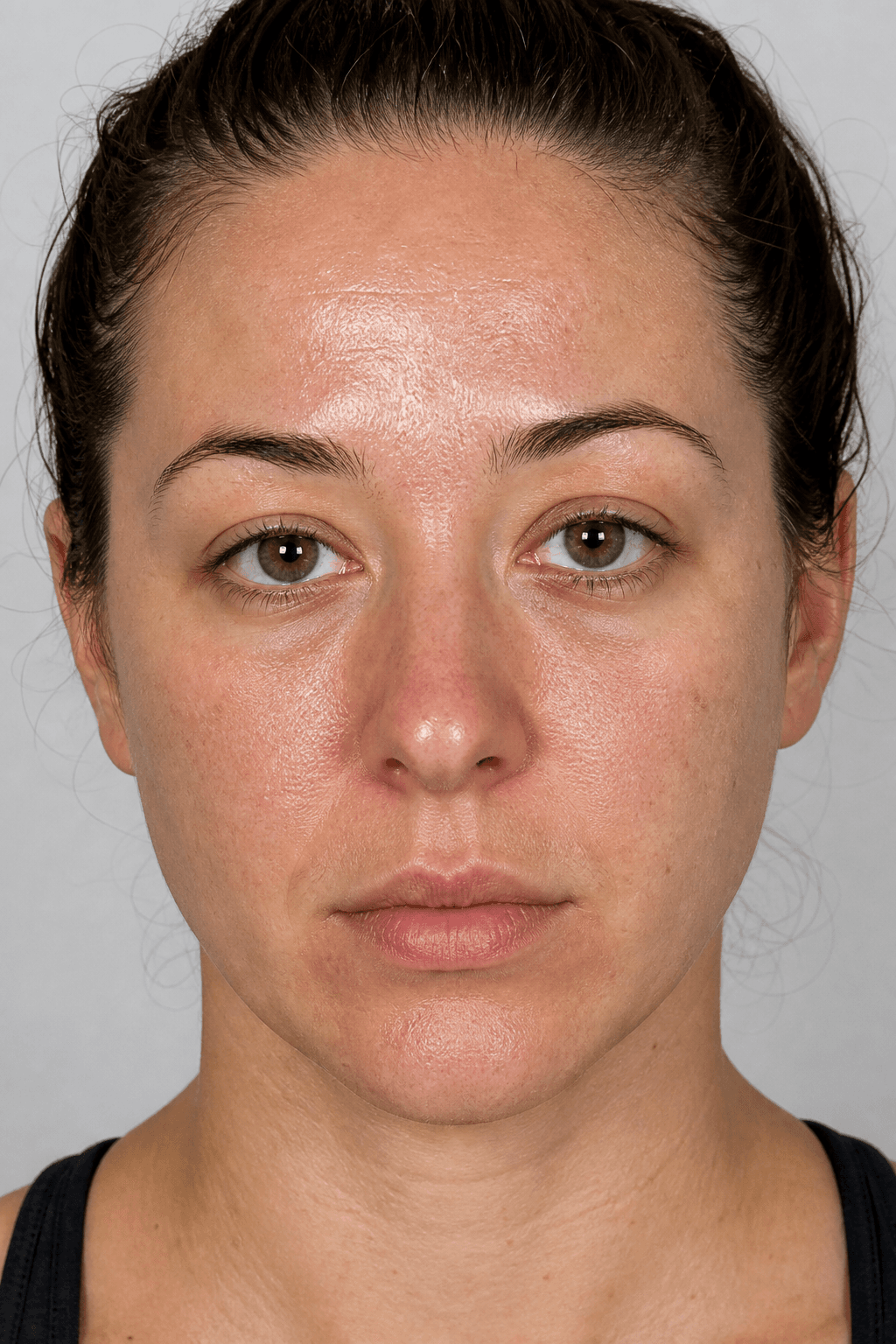 Before facial treatment — illustrative example