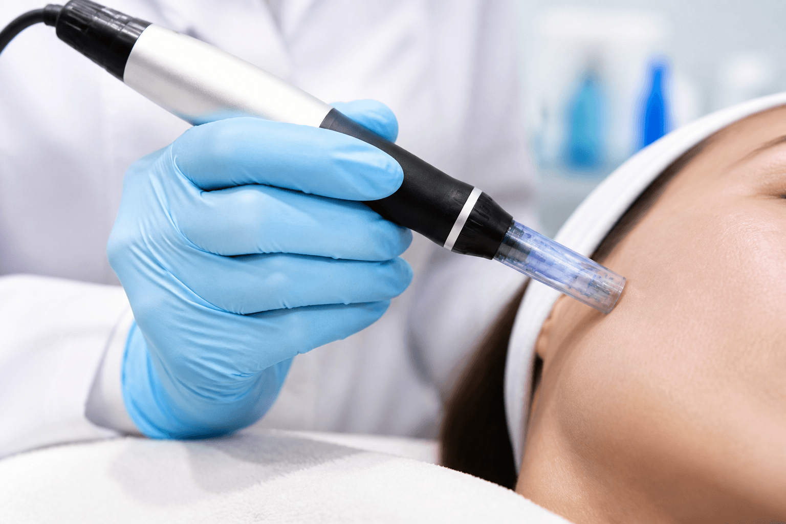 Microneedling treatment closeup, Beauty and Health Skin Care, Little Ferry NJ (placeholder — replace with real photo)